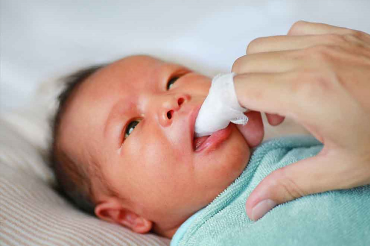 Ngăn ngừa nấm lưỡi ở trẻ sơ sinh