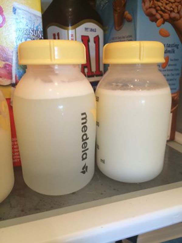 Tại sao sữa mẹ có váng (tách lớp) khi bảo quản trong tủ lạnh hoặc tủ đông?